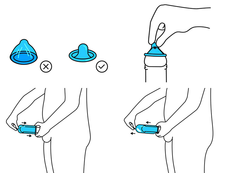 cách sử dụng bao cao su 